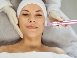 Microneedling treatment in Chandler at Breeze Med Spa rejuvenates skin and improves texture over time.
