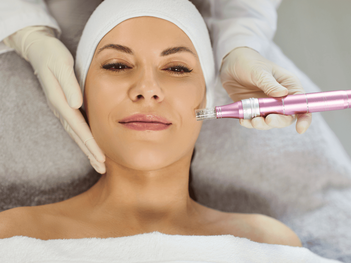 Microneedling treatment in Chandler at Breeze Med Spa rejuvenates skin and improves texture over time.
