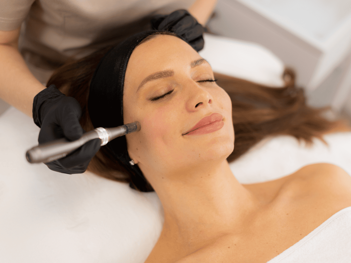 microneedling in Chandler