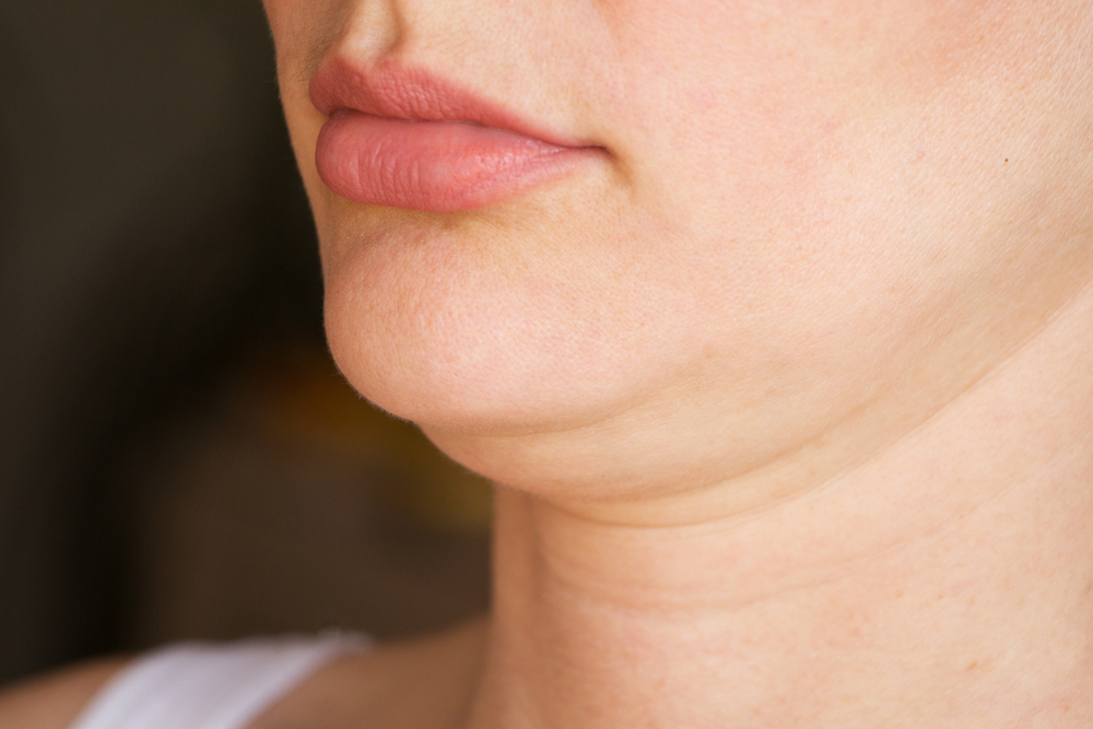 How Much Does Double Chin Treatment Cost in Gilbert, AZ? Experienced Injectors Tell All