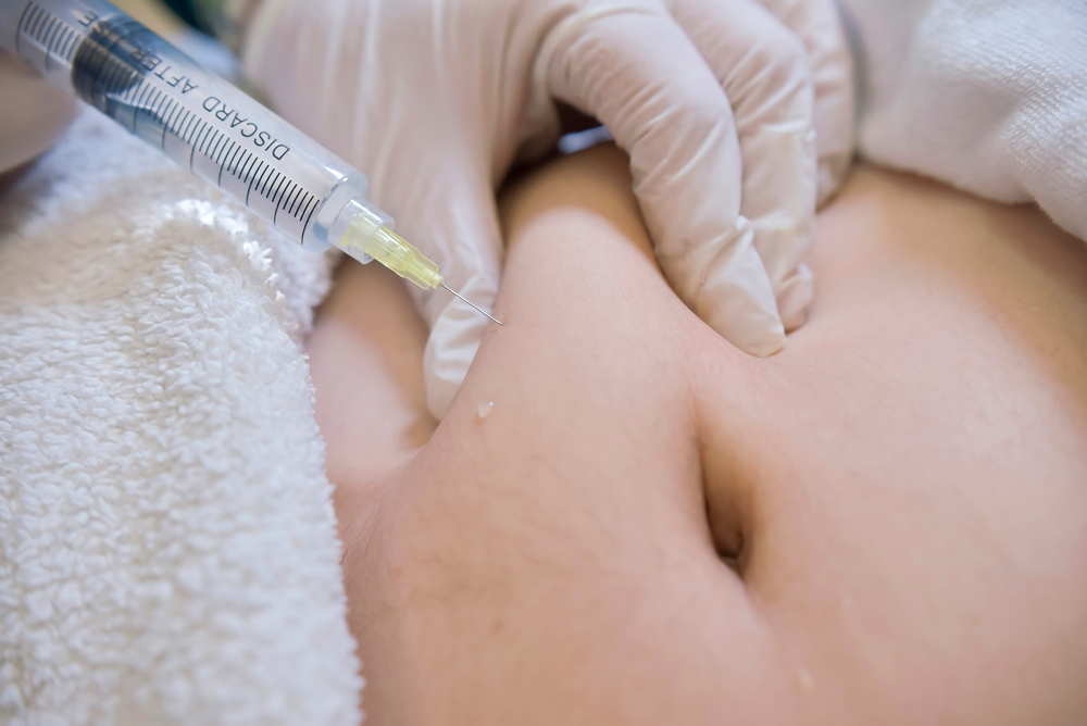 Liquid Lipo Arizona