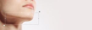 Double Chin Treatment Near Scottsdale and Queen Creek, AZ